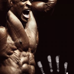 Ronnie Coleman Campeão de Bodybuilding